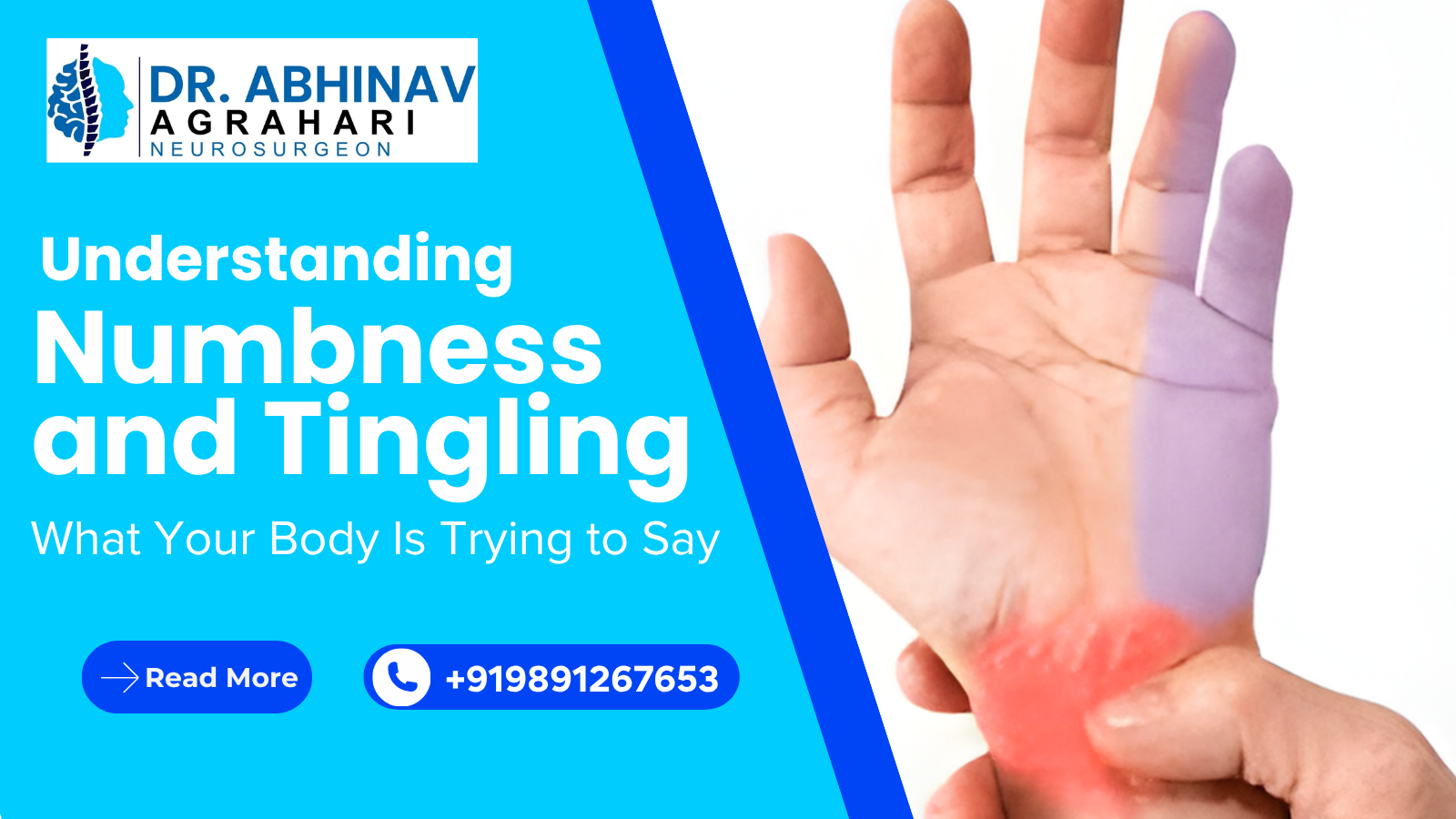 Understanding Numbness and Tingling: What Your Body Is Trying to Say